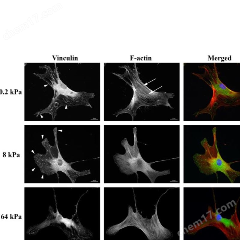5 塊特定彈性模量2kPa）的板