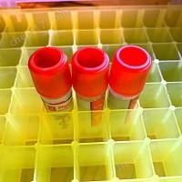 乙酰異戊酰泰樂菌素單克隆抗體