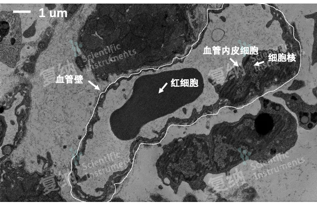 臺式掃透電鏡：血管、血管內皮細胞、紅細胞超微結構