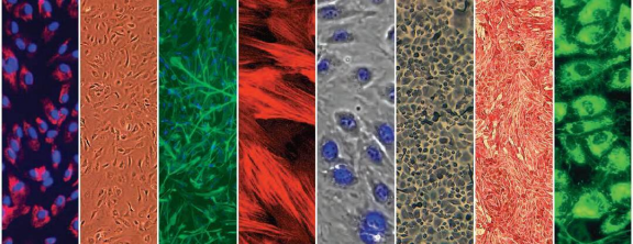 image.png LONZA原代人肺微血管內皮細胞HMVEC-L 產品介紹