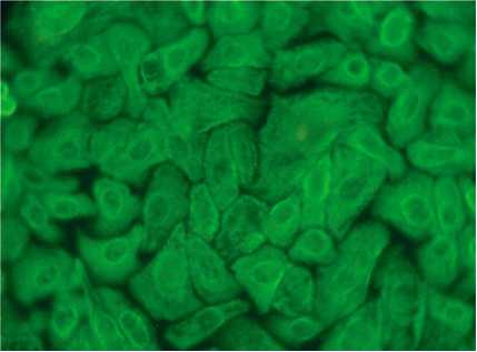 LONZA原代人小气道上皮细胞HSAEC产品介绍