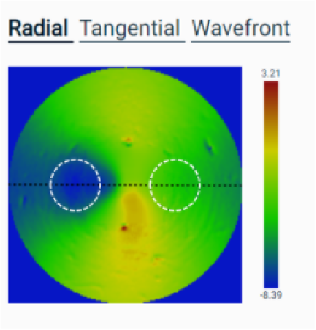 角膜接触镜光学分析仪
